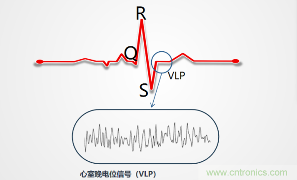解決心電監(jiān)測行業(yè)難題，曼森伯格的濾波技術獲國家知識產權局發(fā)明授權